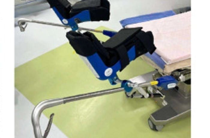 Lithotomy stirrups mounted on a surgical table