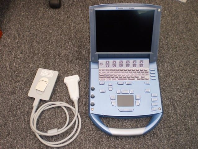 Portable laptop-style point-of-care ultrasound system with an attached linear-array probe
